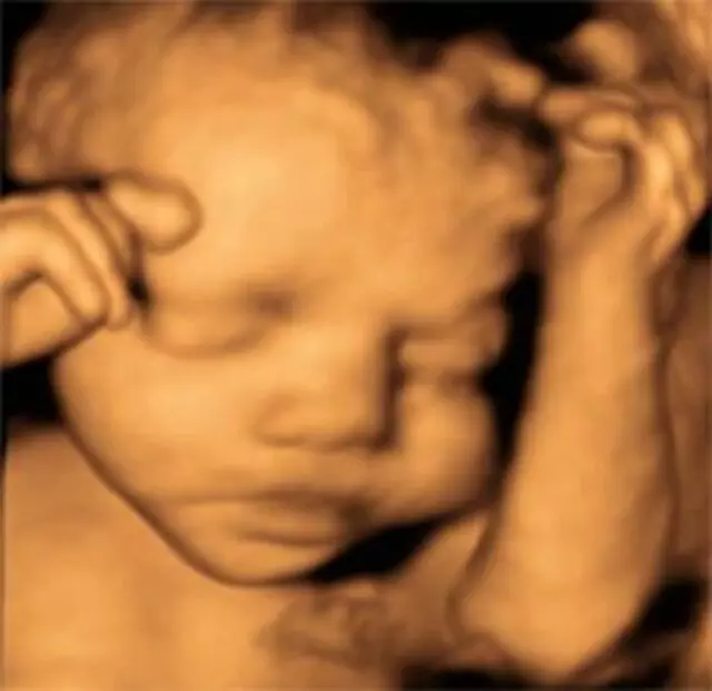 4D First Look