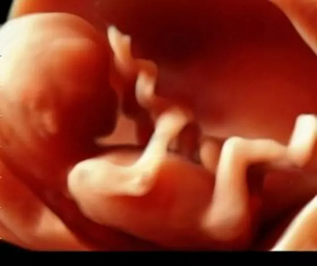 4D First Look