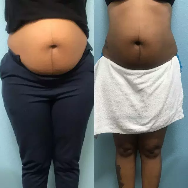 BodiBeautyBar