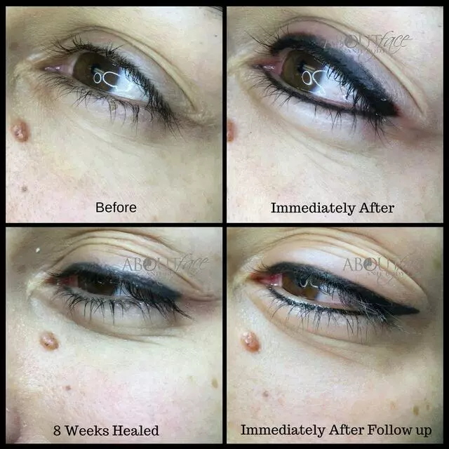 About Face and Body
