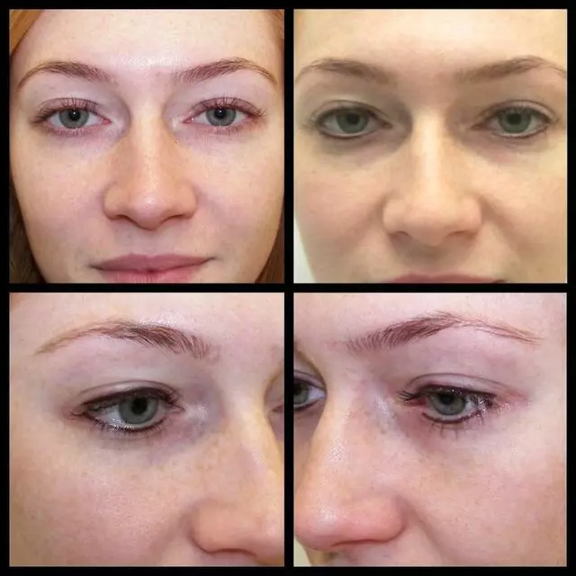 About Face and Body