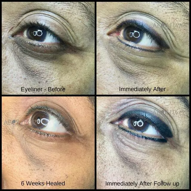 About Face and Body