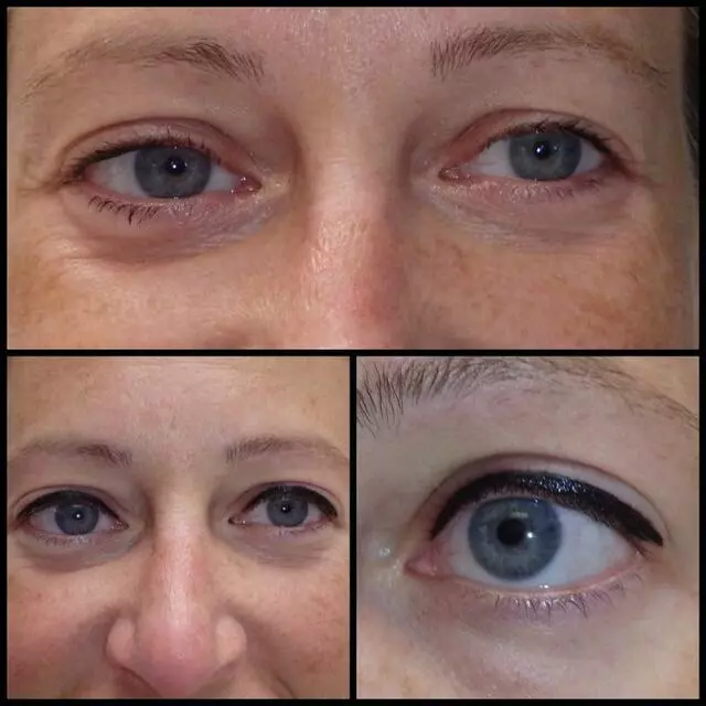 About Face and Body
