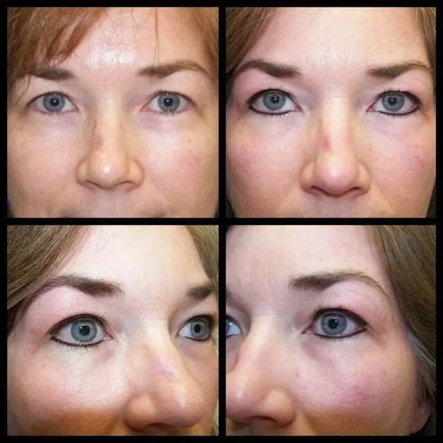 About Face and Body