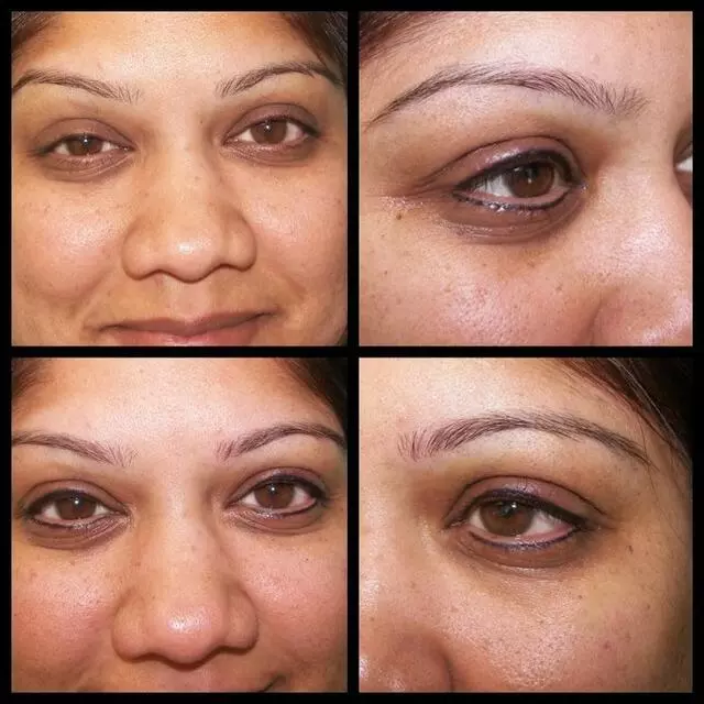 About Face and Body