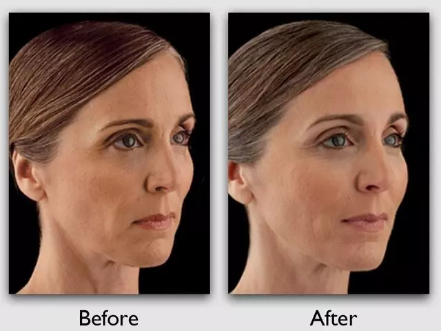 Advanced Centre For Plastic Surgery
