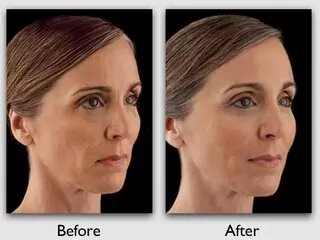 Advanced Centre For Plastic Surgery