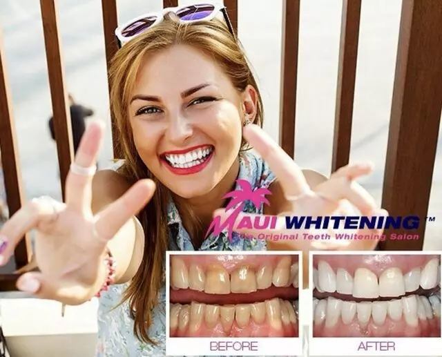 Maui Whitening