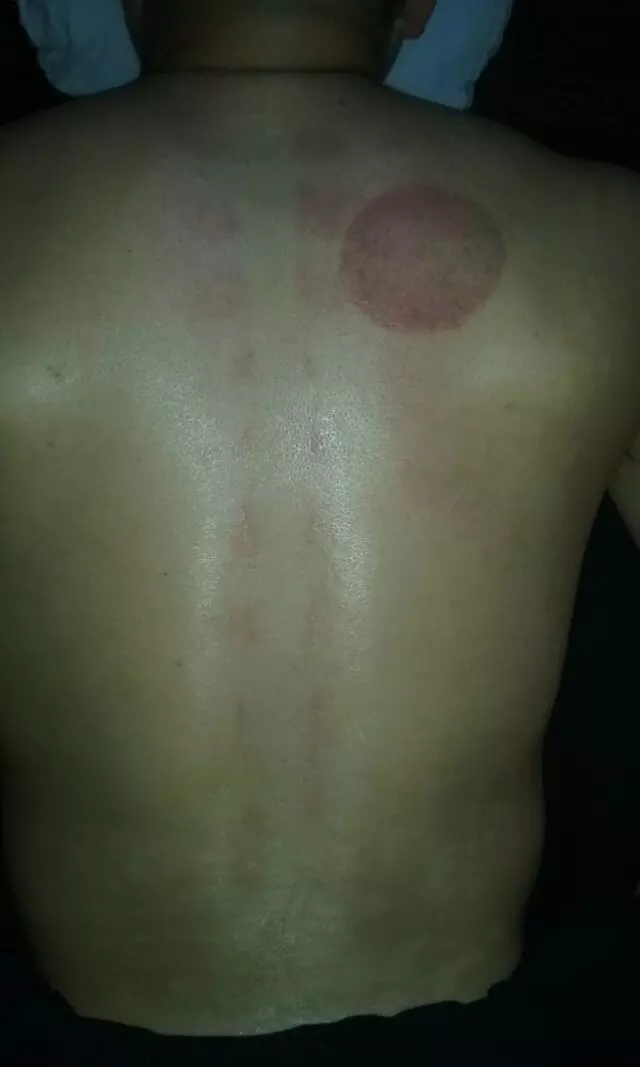 All-Pro Sports Massage