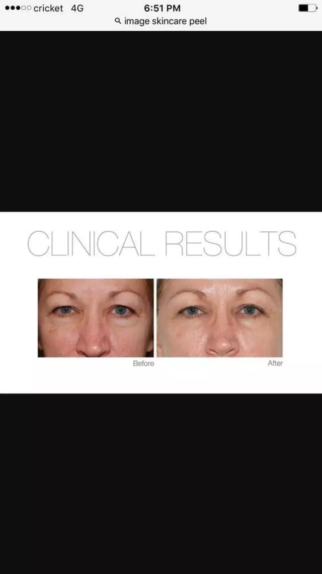 Atlas Lash and skin care