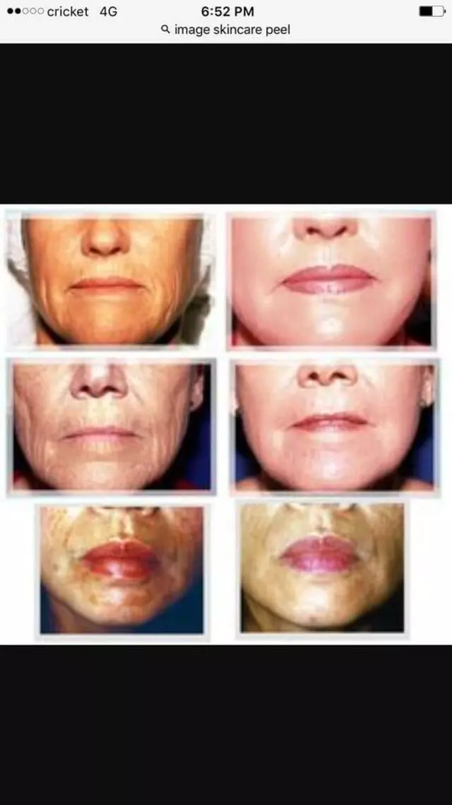Atlas Lash and skin care