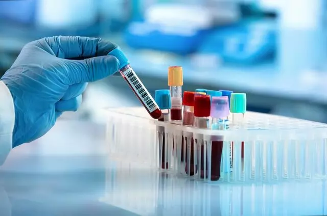 Phlebotomist On-Demand Services