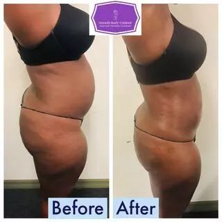 Smooth Body Contour LLC