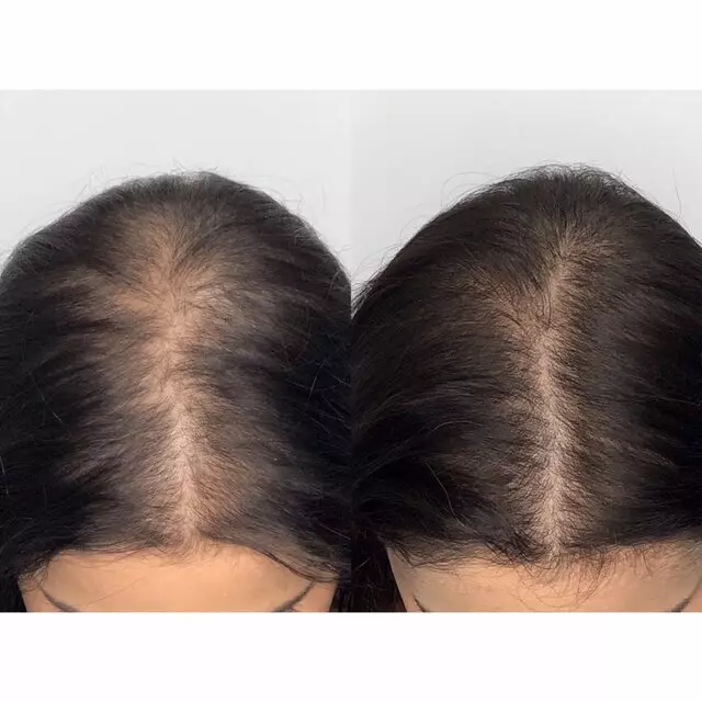 USA Hair Clinic